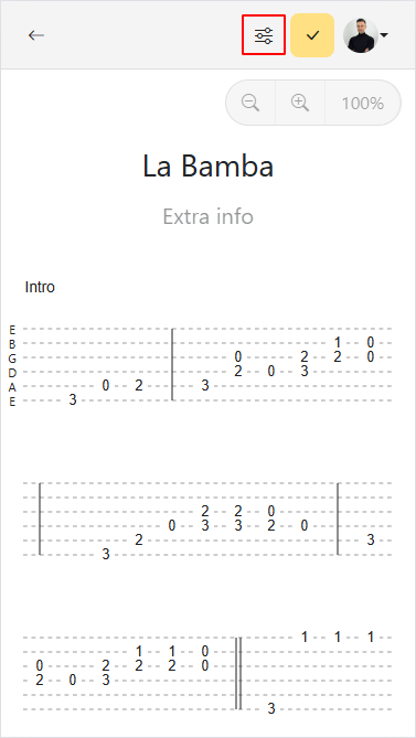 Botón de configuración de canción